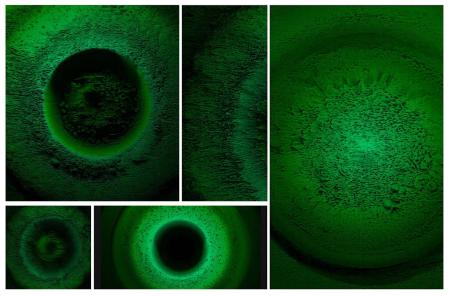 Fotogramas del audiovisual Biorehabilitación bacteriana
